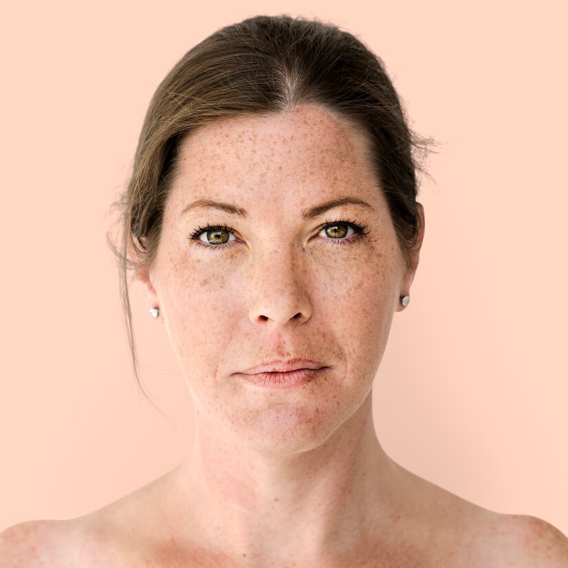 Hyperpigmentation and Hypopigmentation